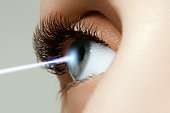 PRK photorefractive keratectomy