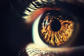 lasik