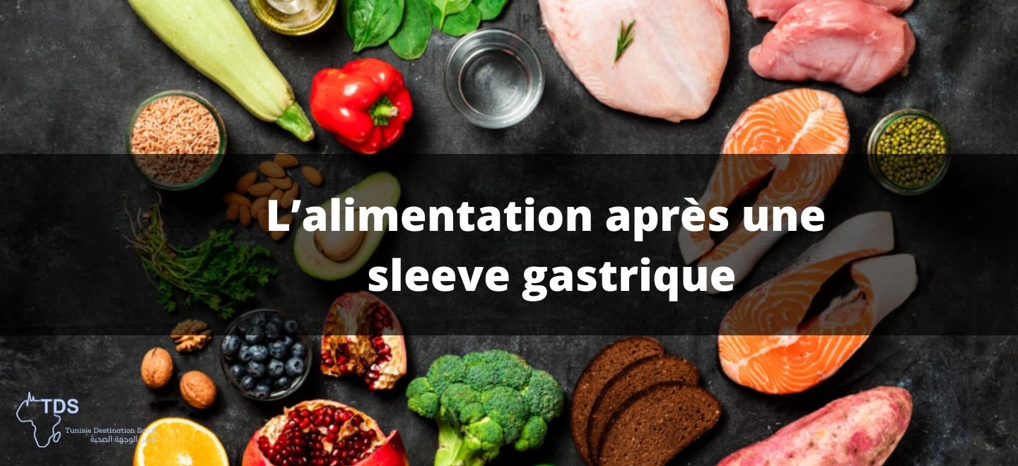 alimentation apres sleeve