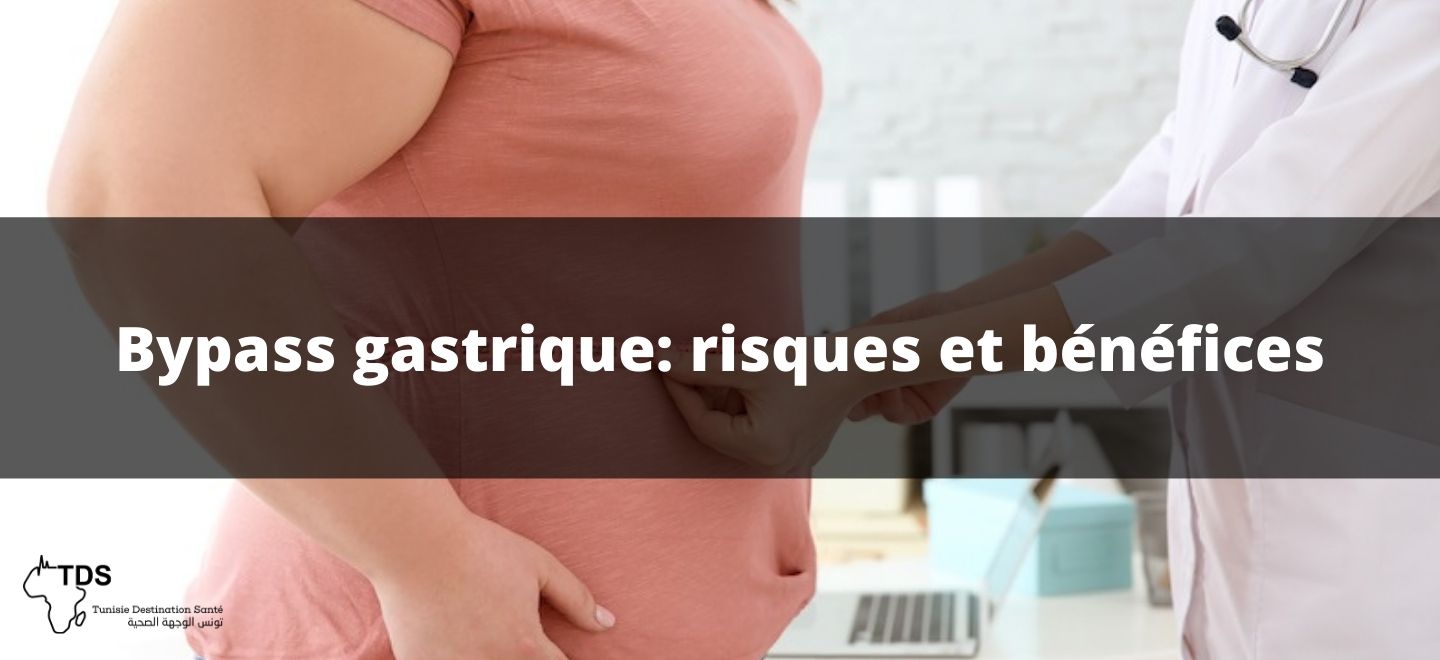 risque et bénéfices sur le bypass gastrique