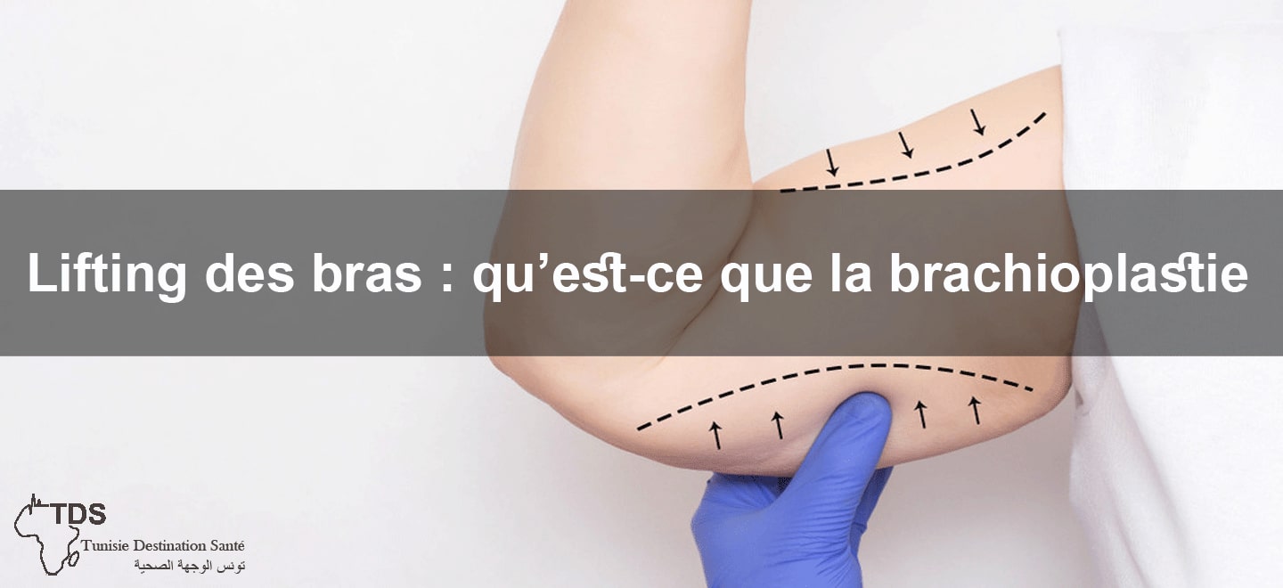 lifting des bras