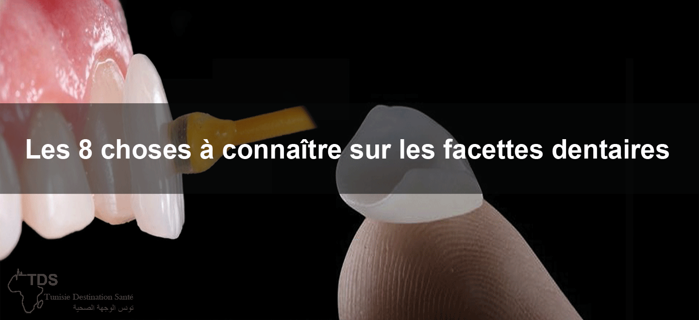 8-choses-facettes-dentaires