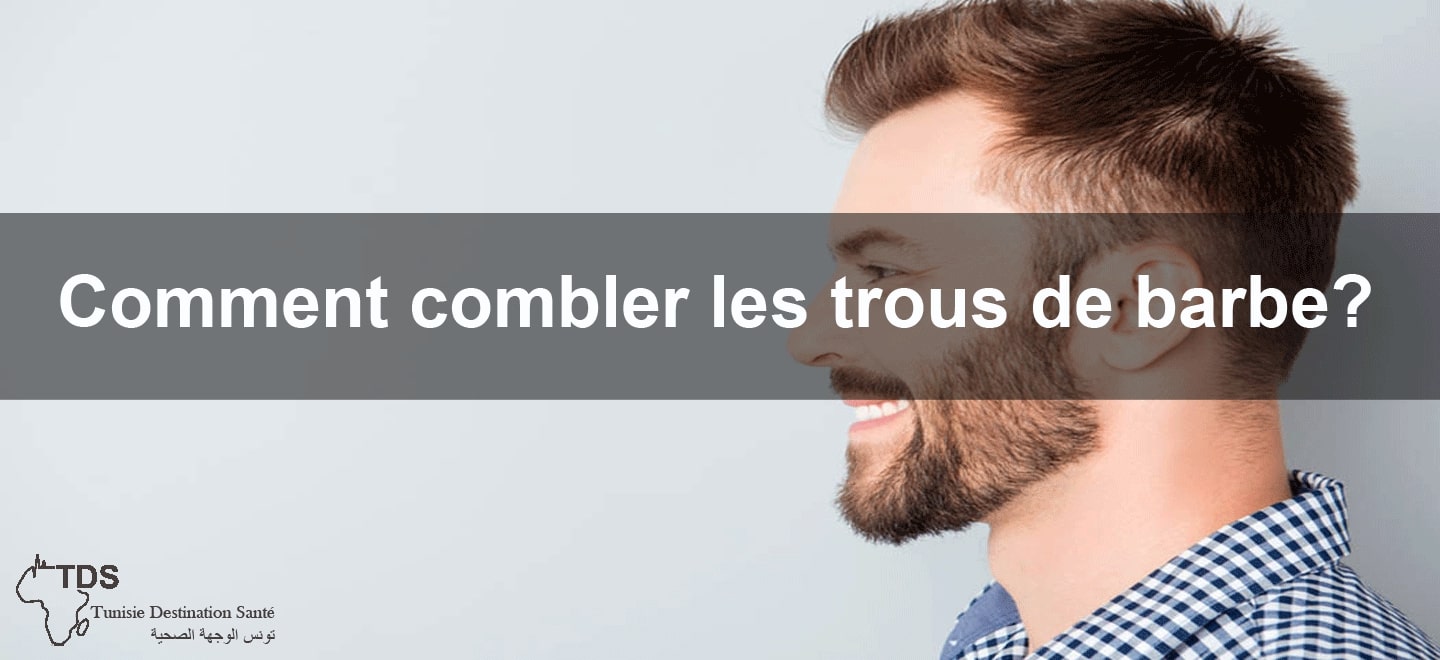 Combler trous dans la barbe