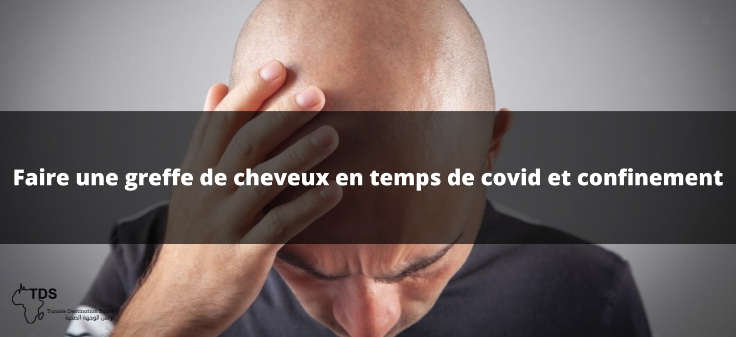 Faire une greffe de cheveux en temps de covid et confinement