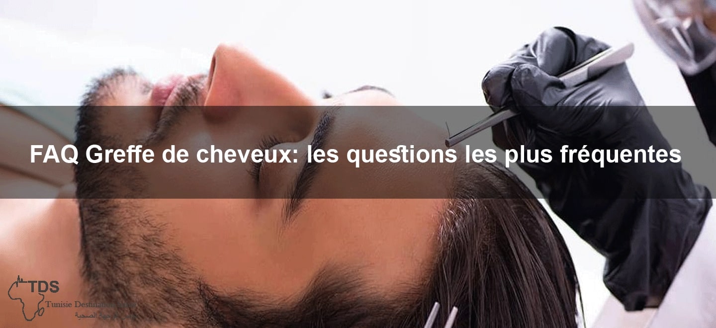 Faq greffe de cheveux