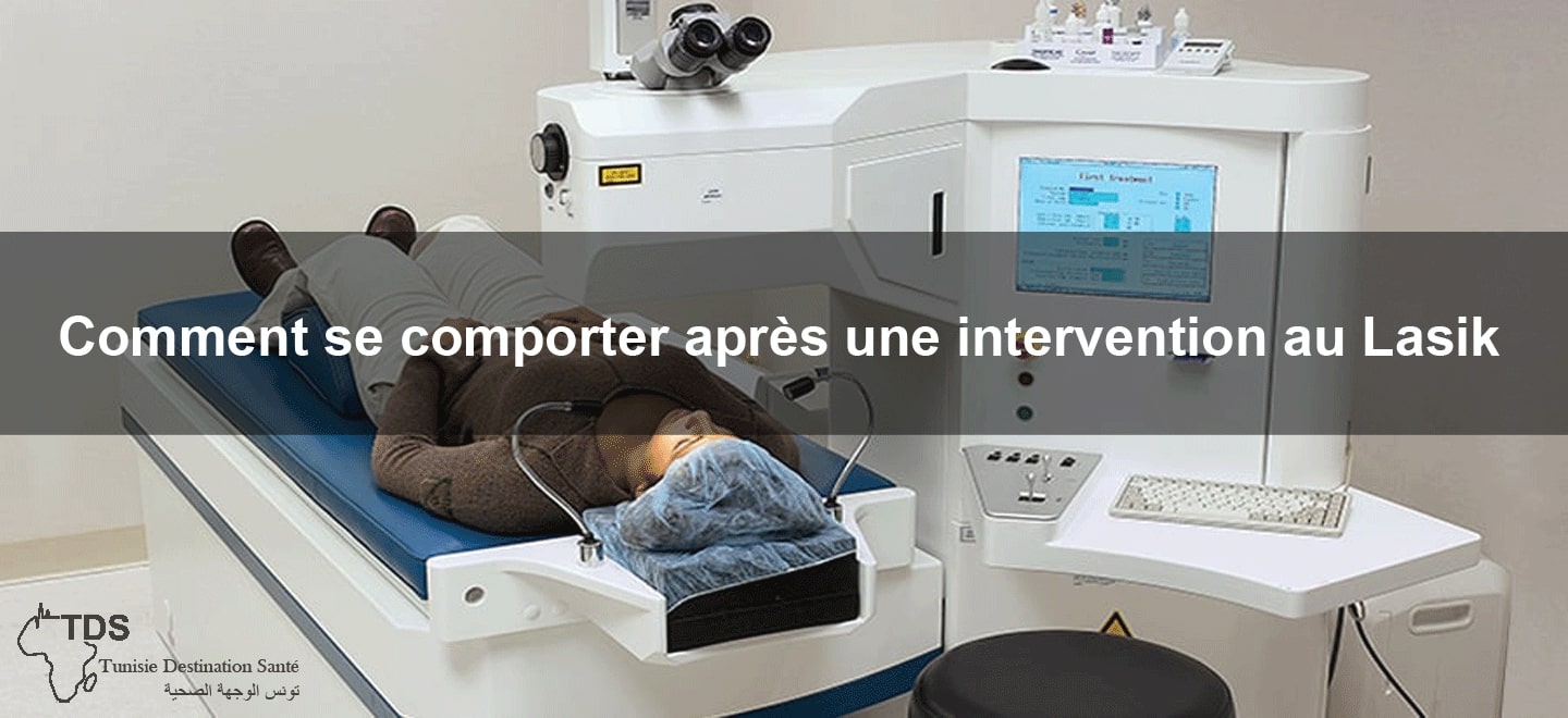 comment intervention lasik