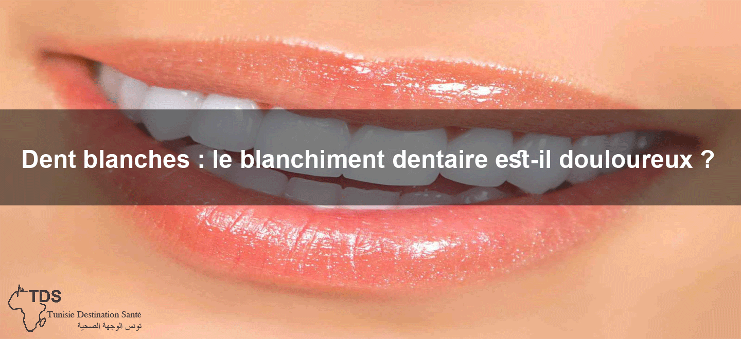 dents blanche