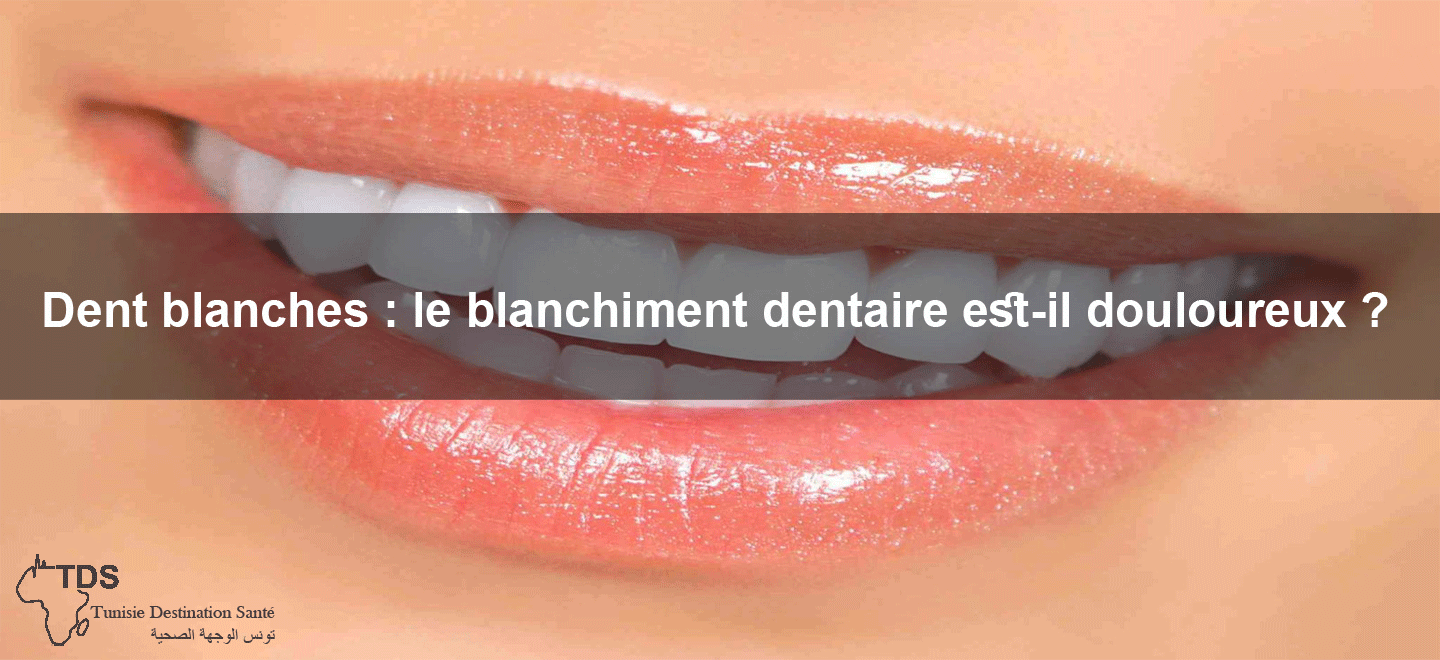 Blanchir ses dents avec le bicarbonate - Sourire d'orient