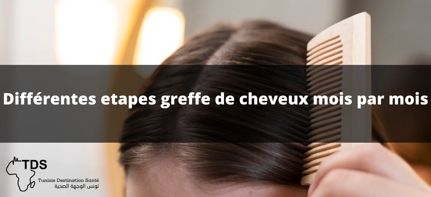 greffe de cheveux