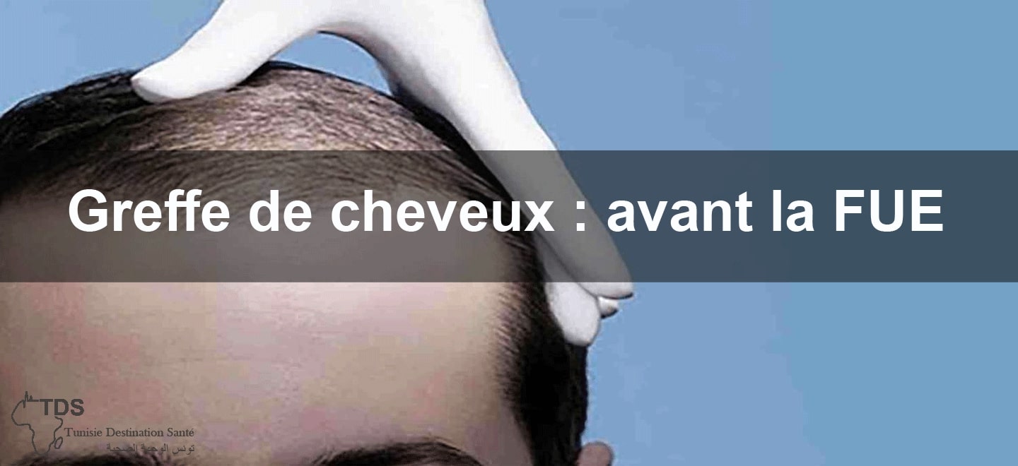 greffe cheveux avant fue