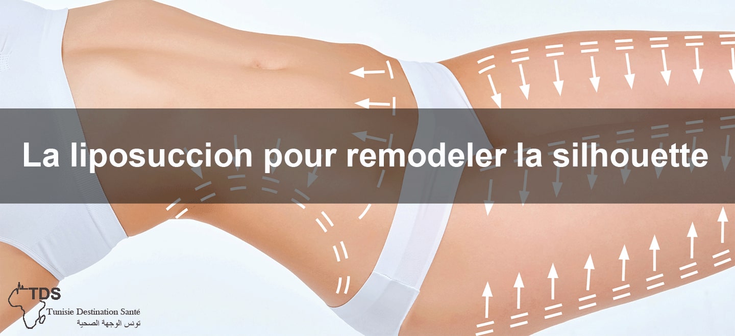 liposuccion pour remodeler silhouette