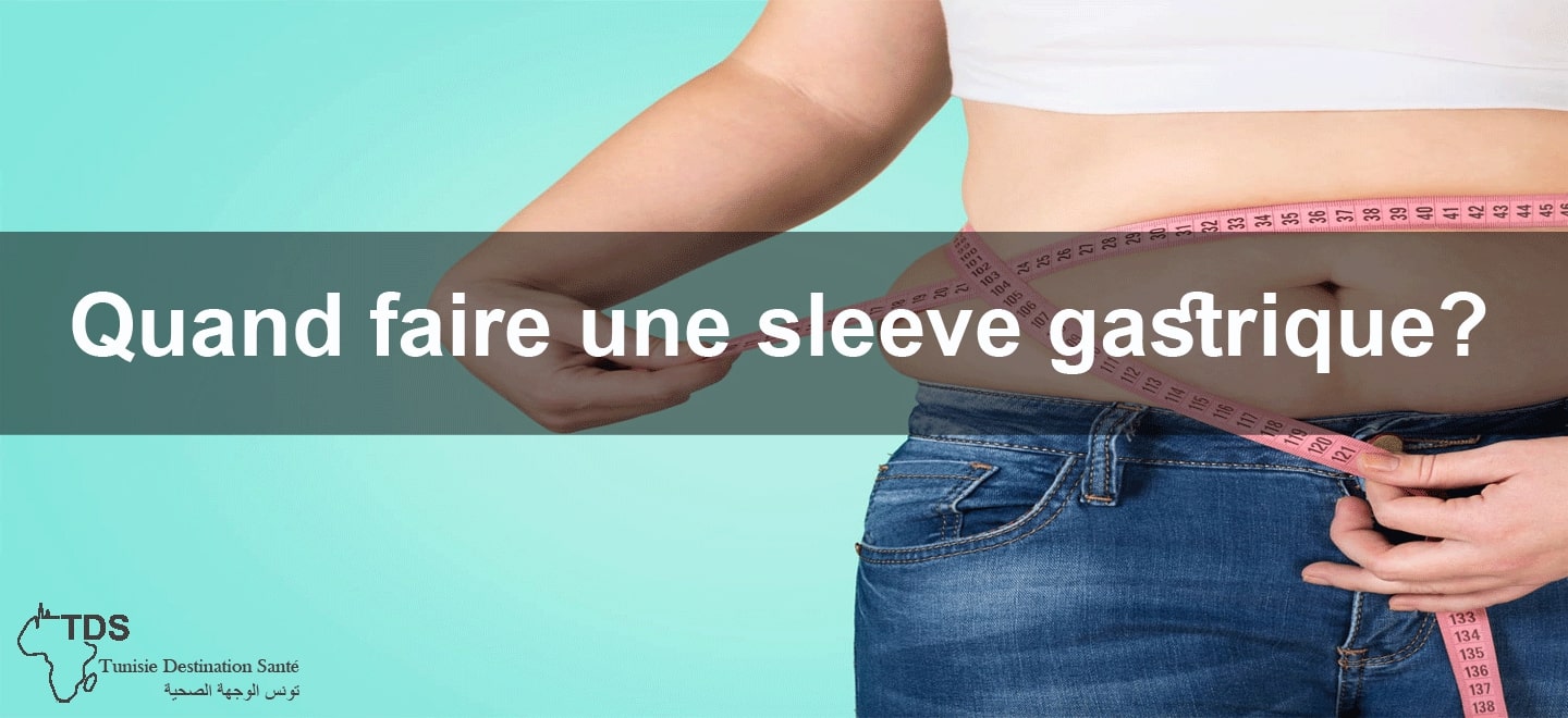 quand faire une sleeve gastrique?