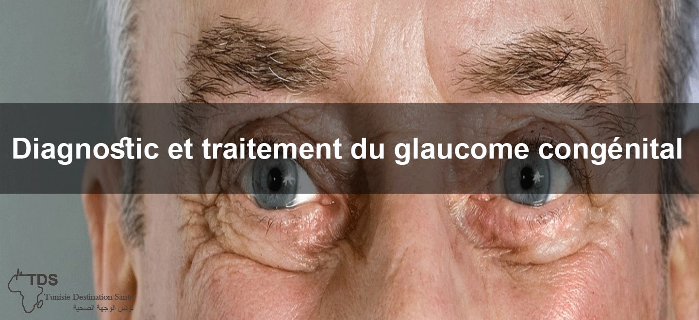 traitement glaucome congenital