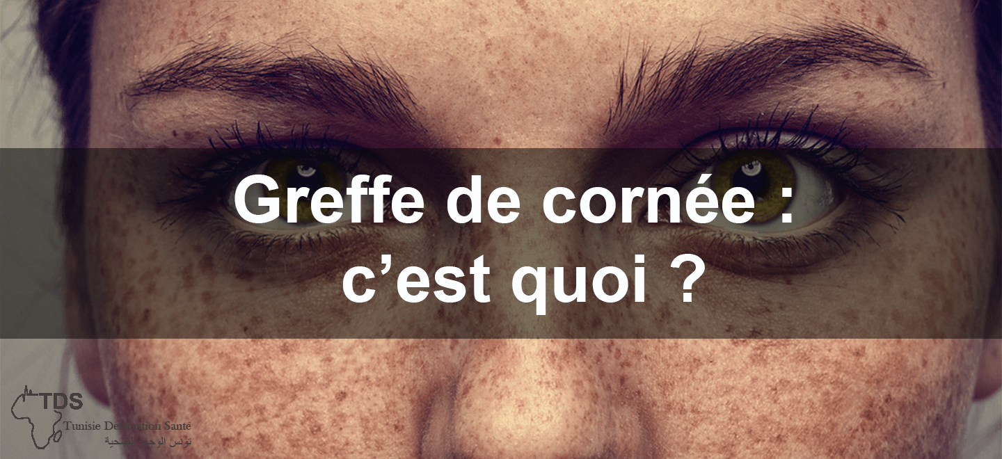 greffe de cornée c'est quoi