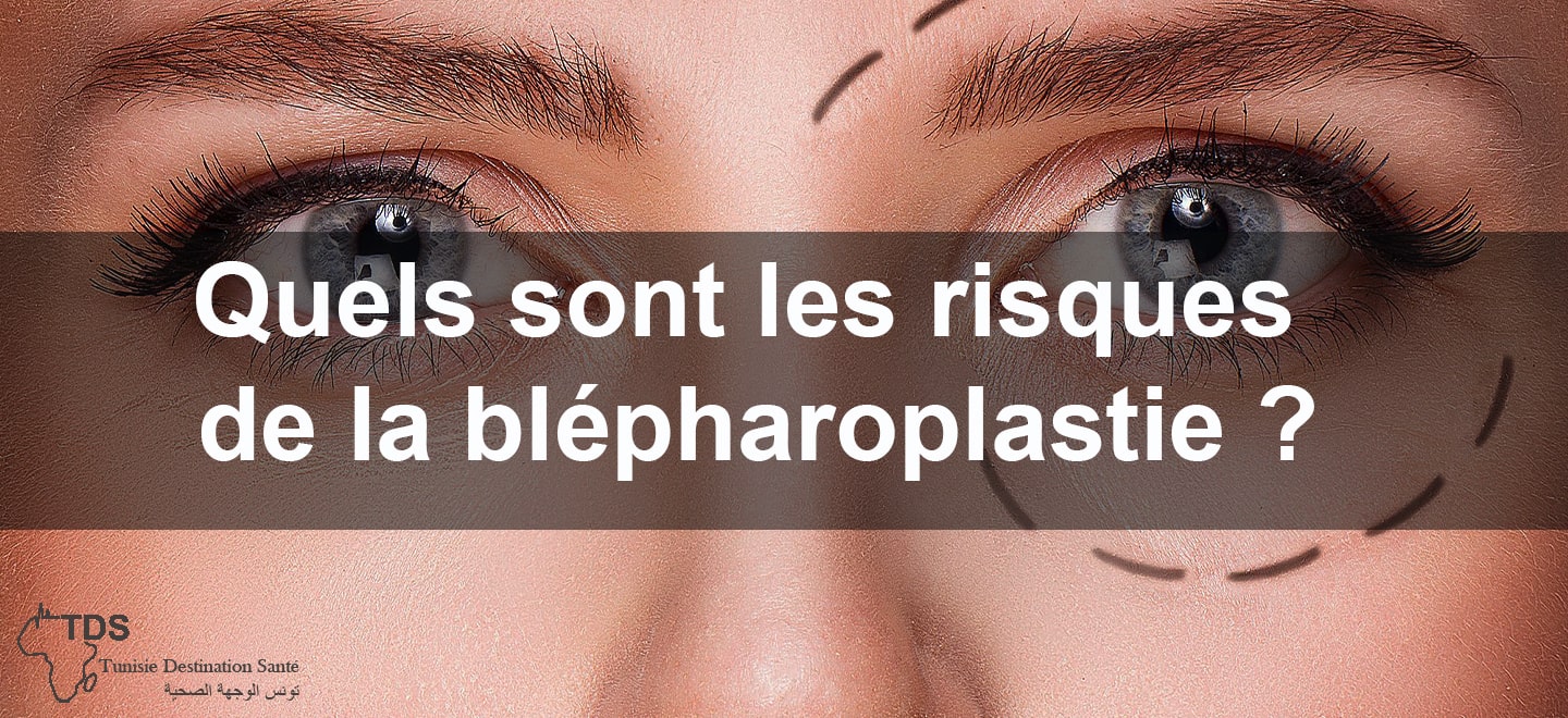 Quels sont les risques de la blepharoplastie