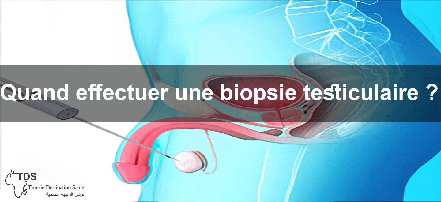 biopsie testiculaire