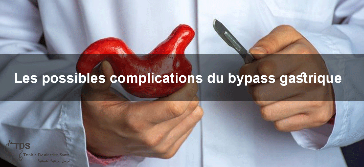 complications-bypass-gastrique