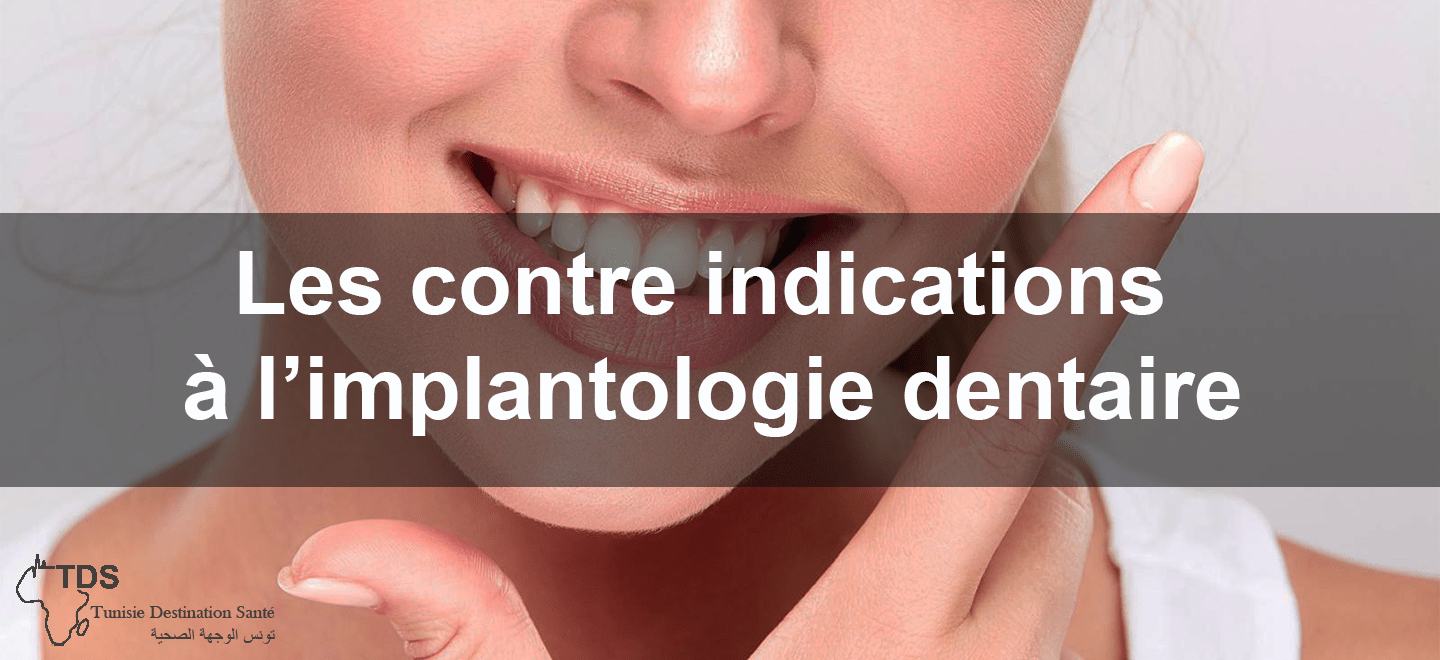 indications à l'implantologie dentaire