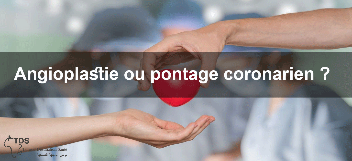 pontage-aorto-coronarien