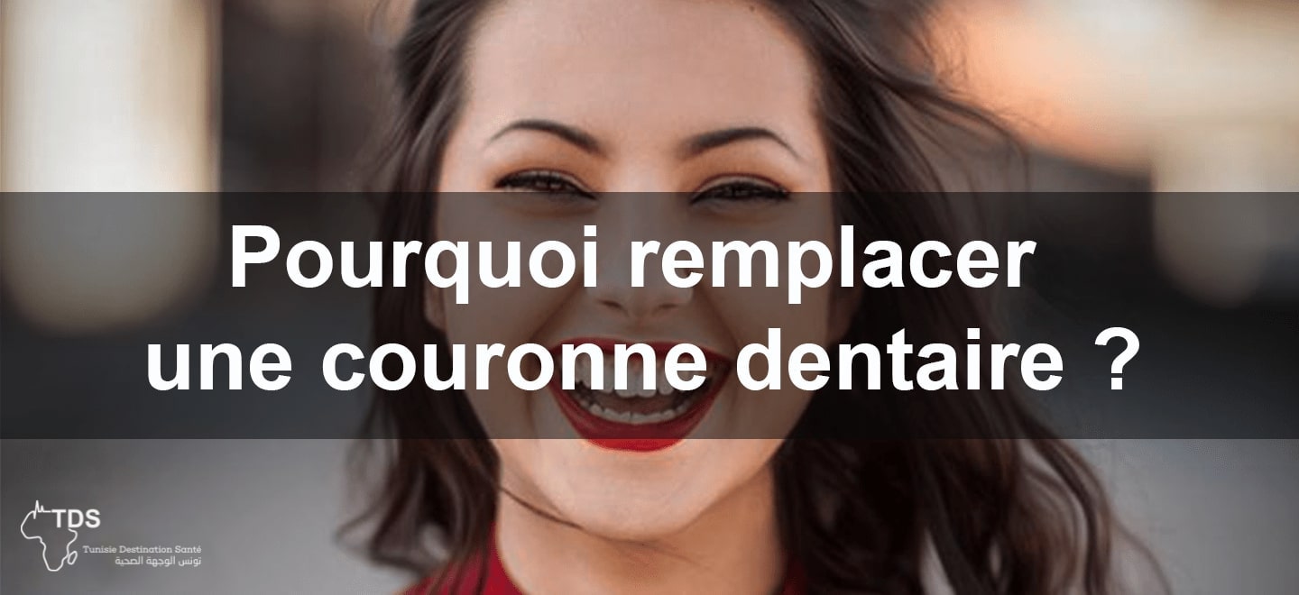 remplacer couronne dentaire