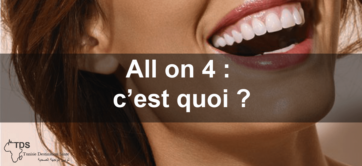 All on 4 c'est quoi