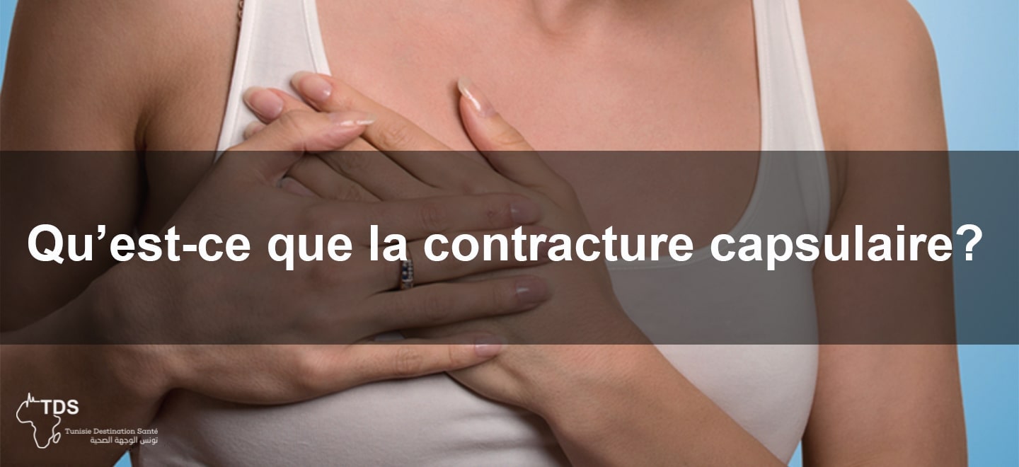 la contracture capsulaire