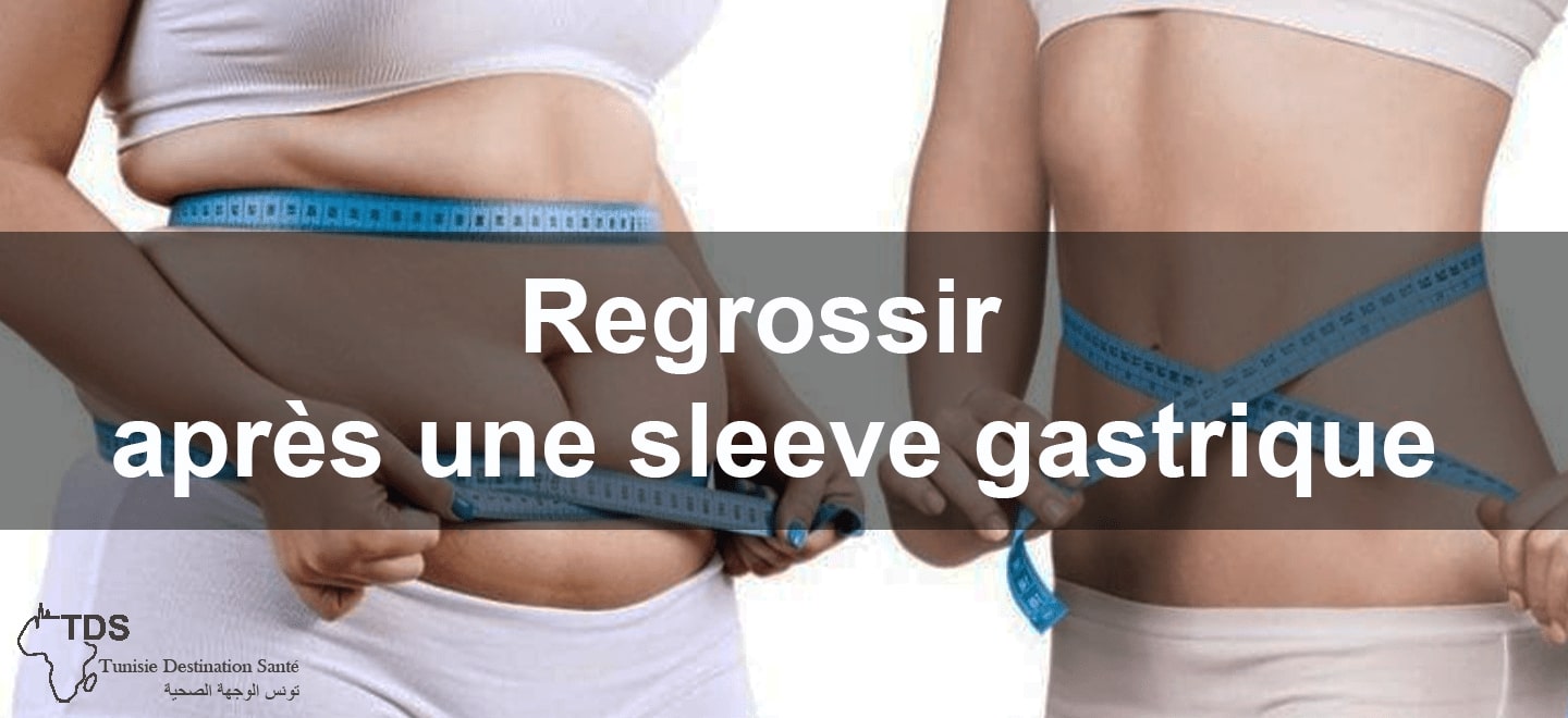 Regrossir apres une sleeve gastrique