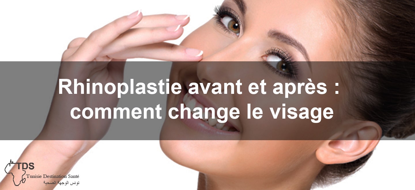 Rhinoplastie avant et apres comment change le visage