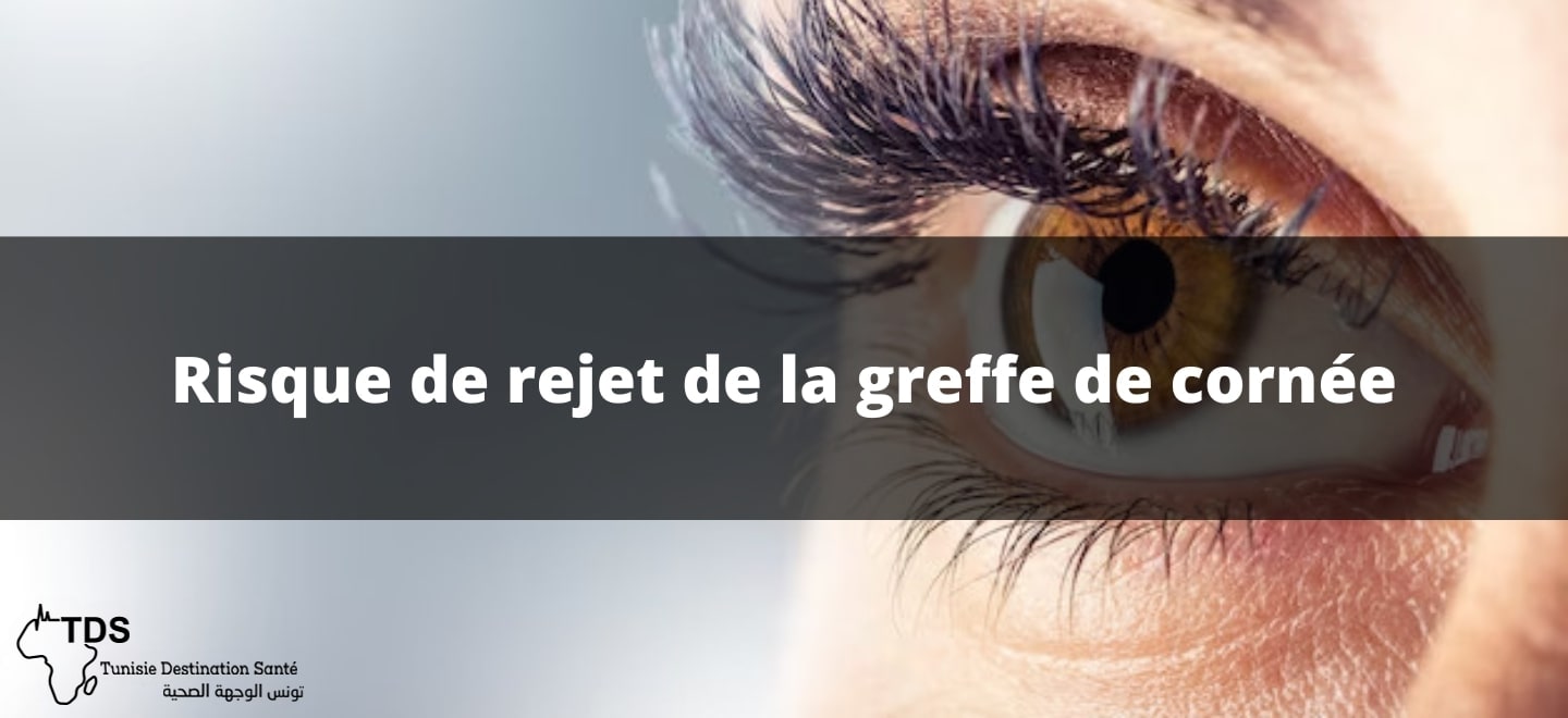 rejet greffe de cornée