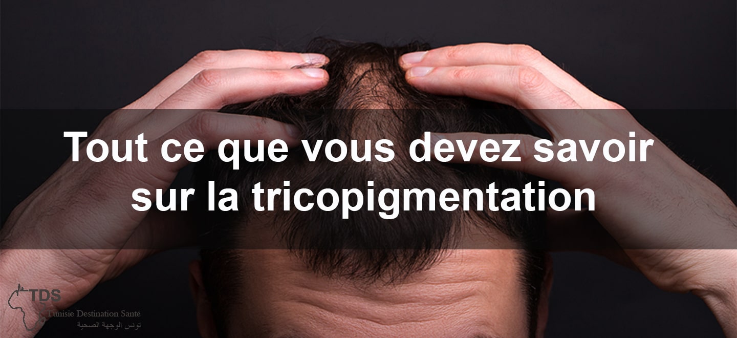 Tout ce que vous devez savoir sur la tricopigmentation