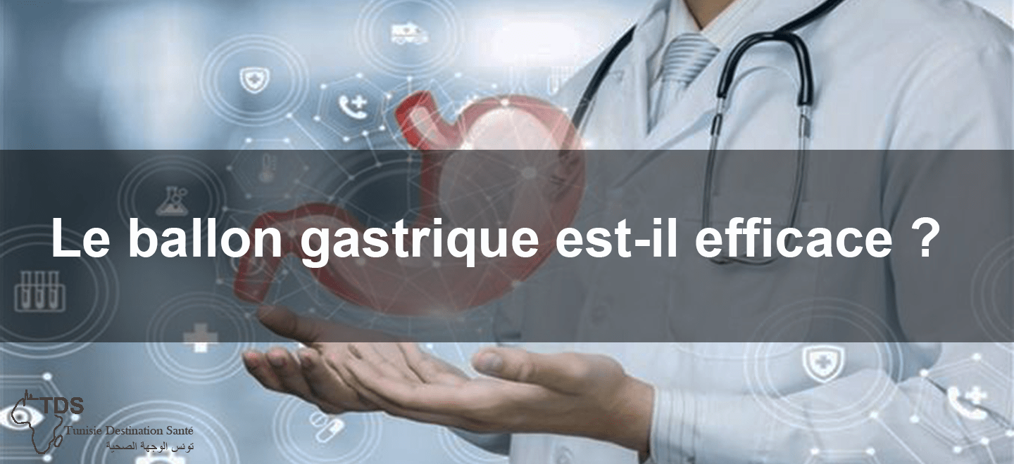 ballon gastrique est - il efficace