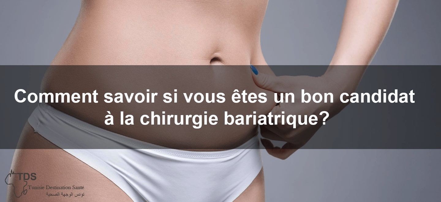 candidat chirurgie bariatrique