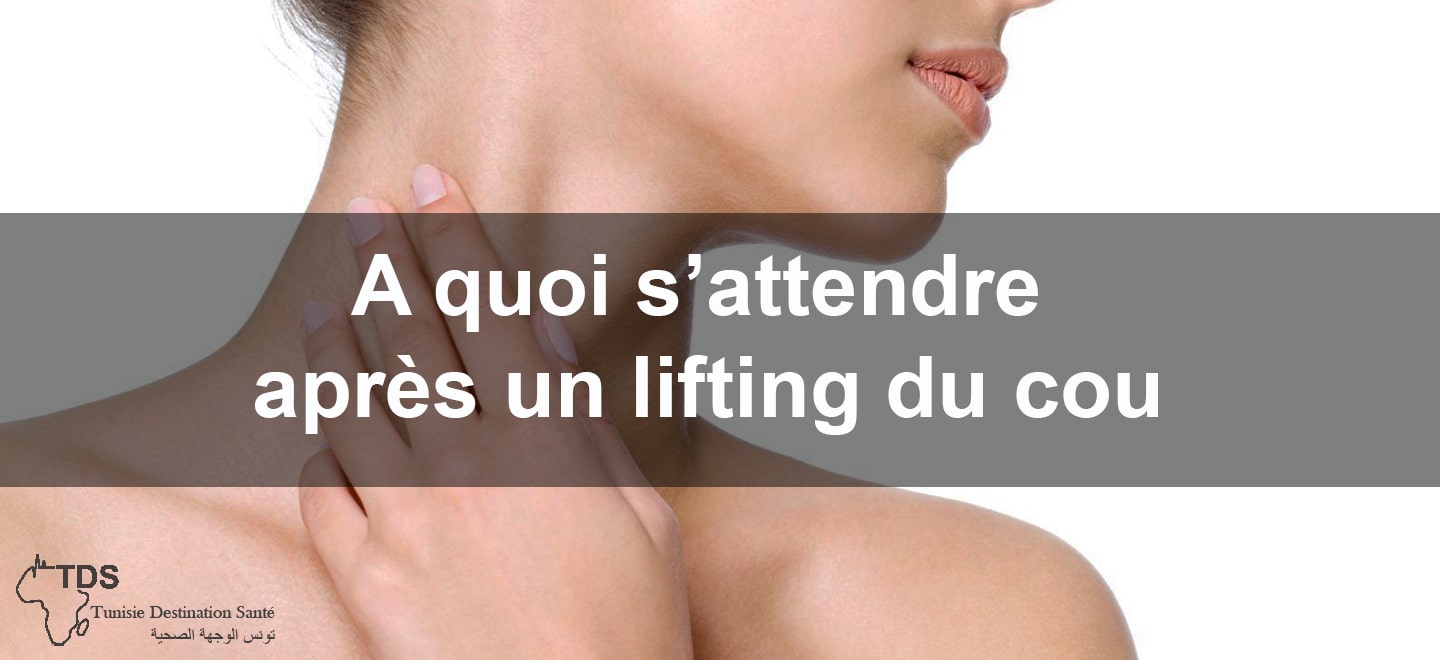 A quoi sattendre apres un lifting du cou