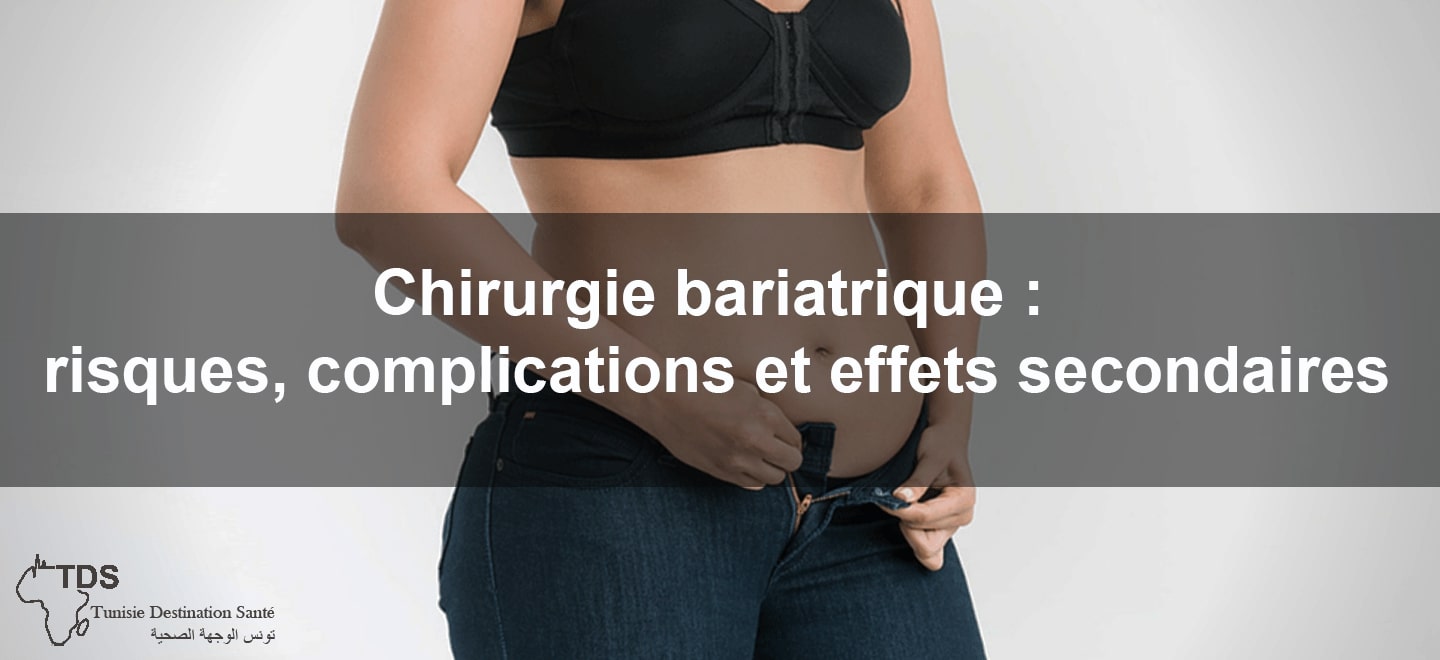 chirurgie bariatrique : risques, complications