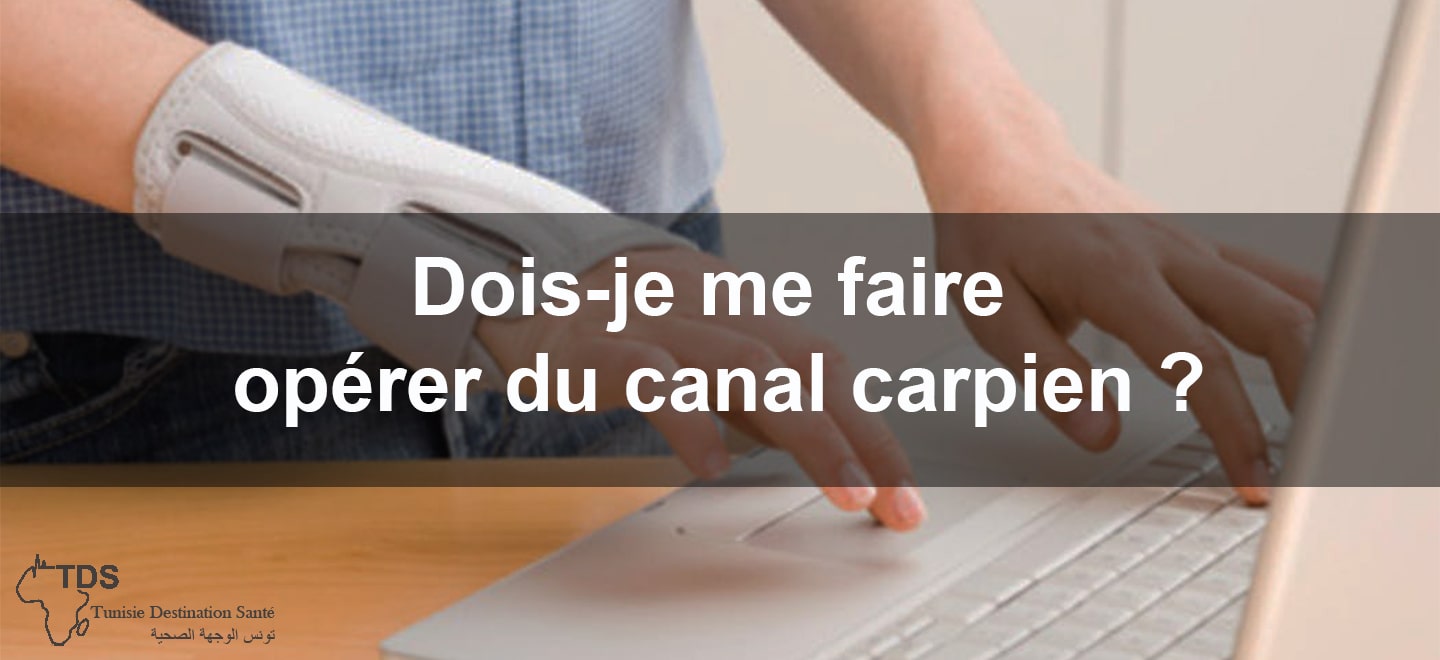 Dois je me faire operer du canal carpien