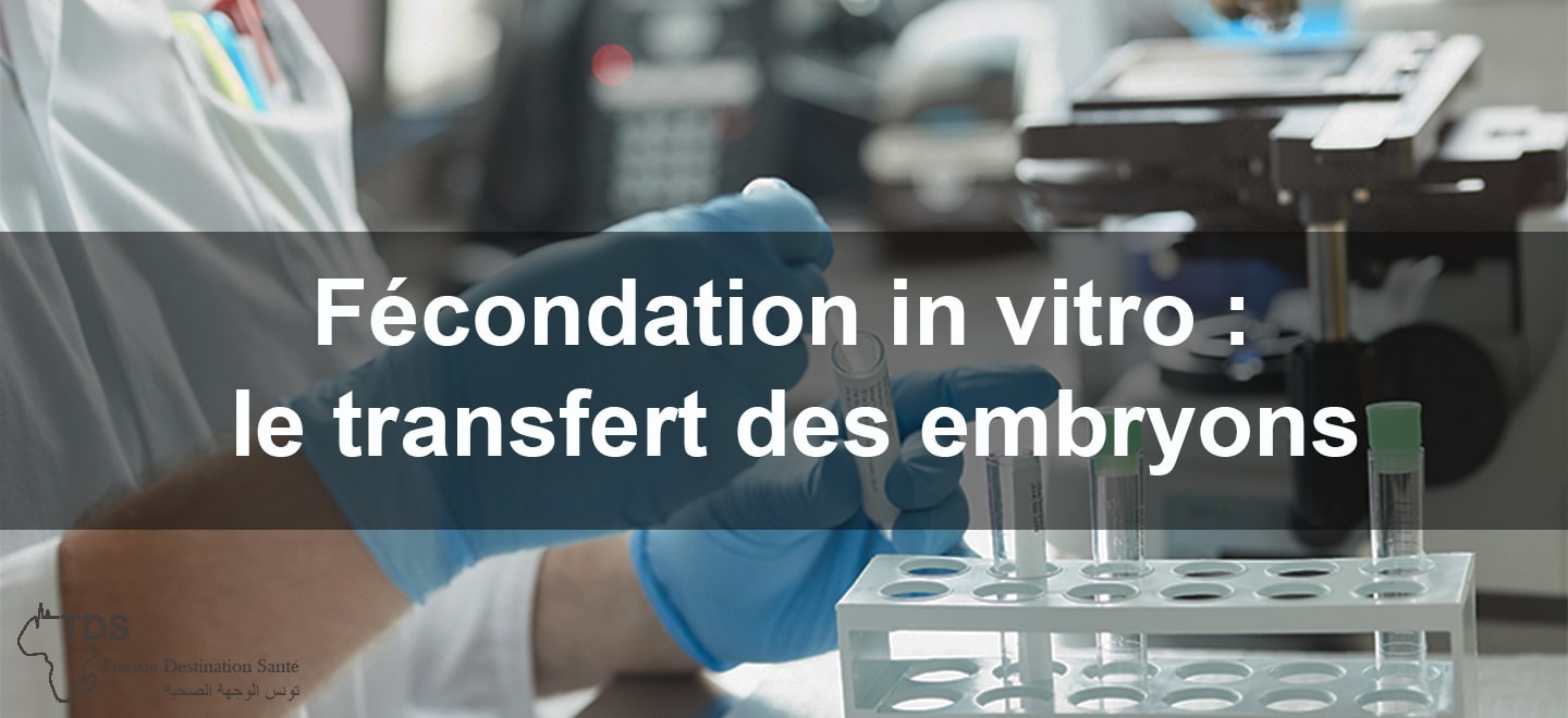 Fecondation in vitro le transfert des embryons