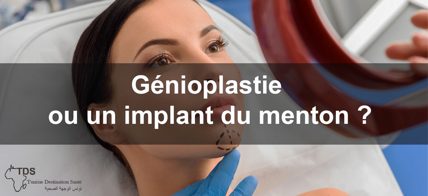 Genioplastie ou un implant du menton