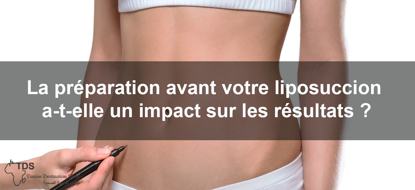 La-préparation-avant-votre-liposuccion-a-t-elle-un-impact-sur-les-résultats