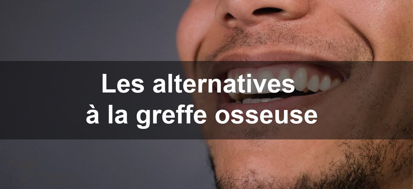 Les alternatives a la greffe osseuse