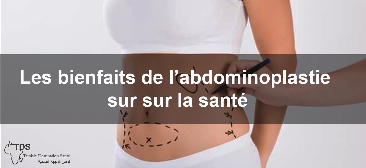 Les bienfaits de labdominoplastie sur la sante