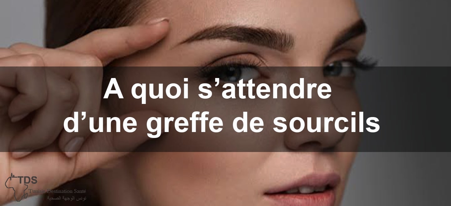 A quoi sattendre d une greffe de sourcils