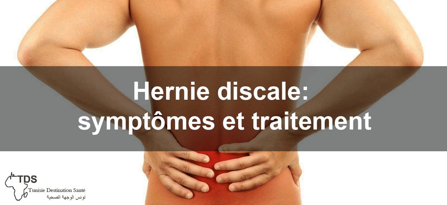 Hernie discale