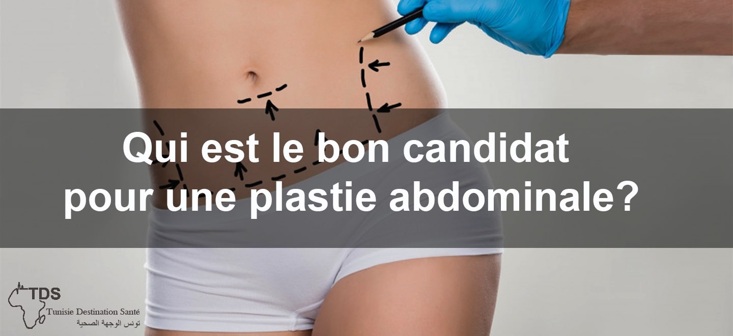Qui est le bon candidat pour une plastie abdominale?