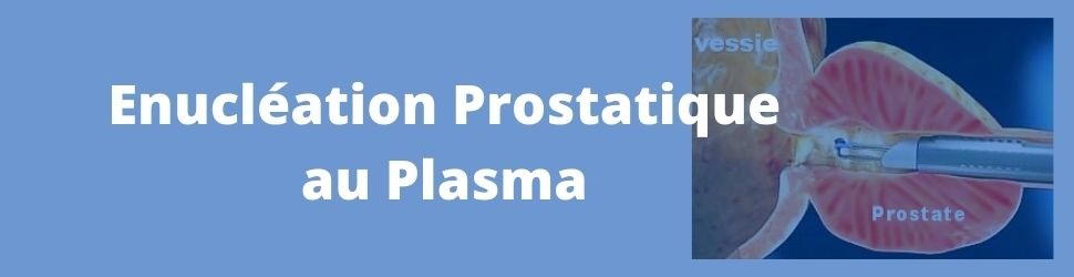 enucléation prostatique au plasma urologie