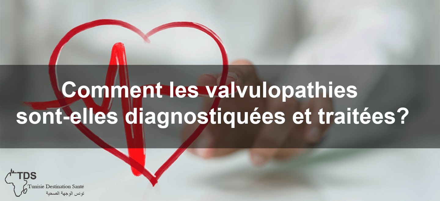 valvulopathies diagnostiquees traitees