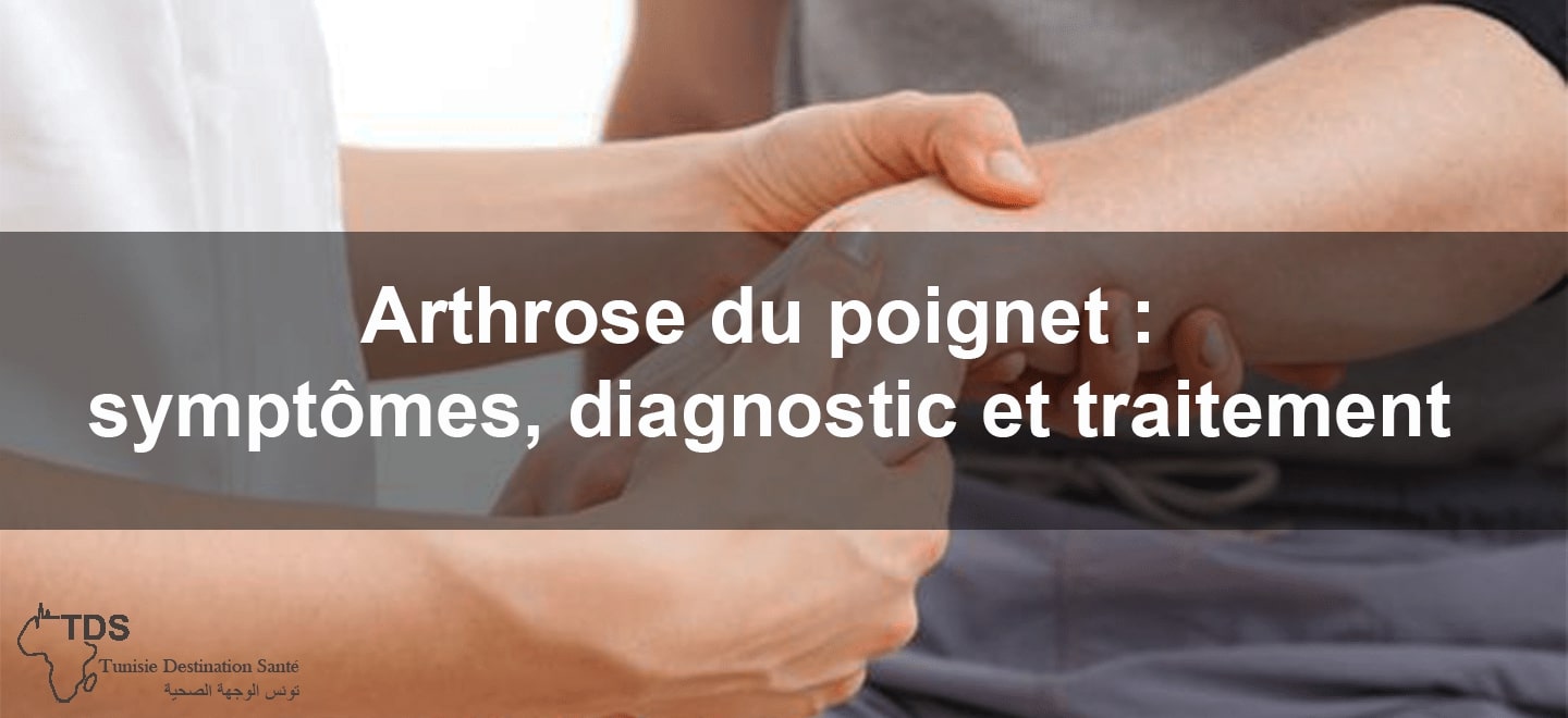 Arthrose du poignet symptomes.