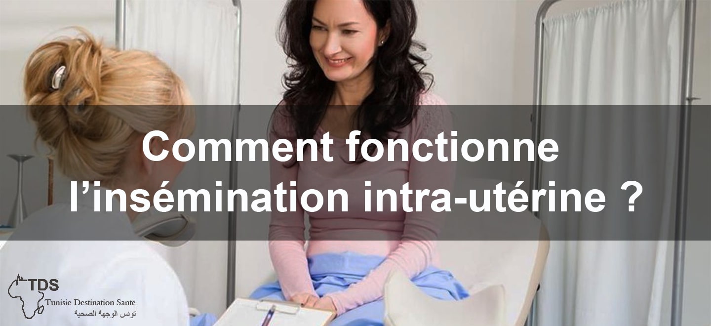 Comment fonctionne linsemination intra uterine