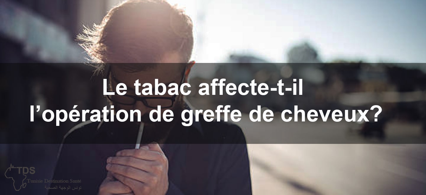 Le tabac affecte t il loperation de greffe de cheveux