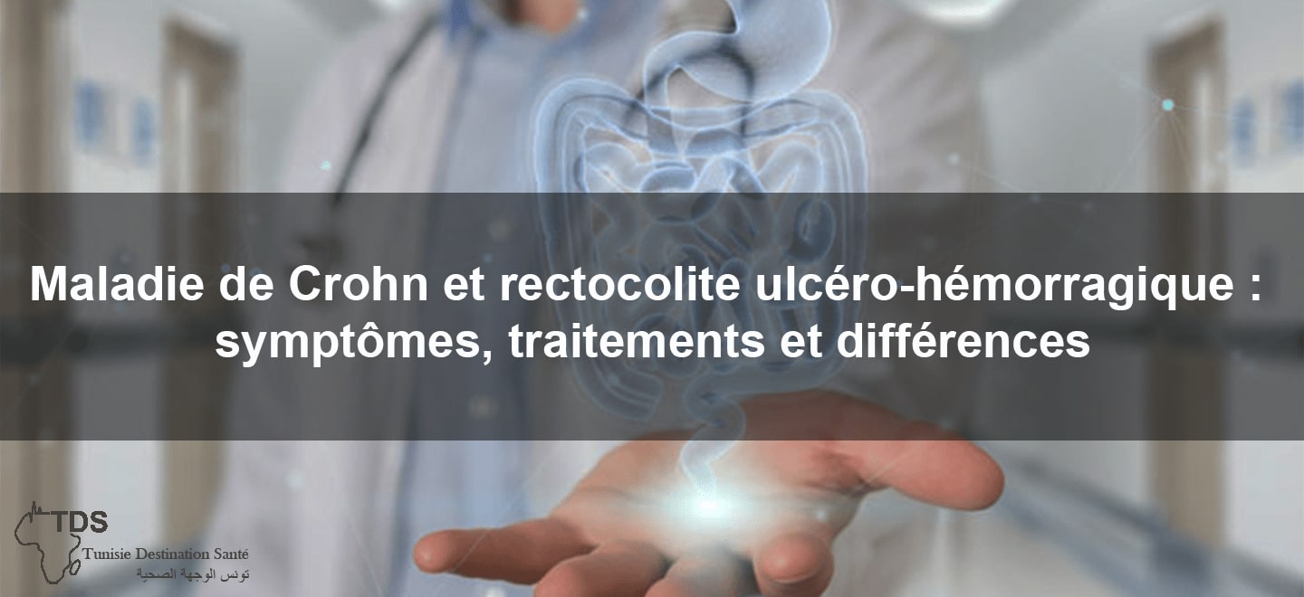 Maladie de Crohn et rectocolite ulcero hemorragique symptomes