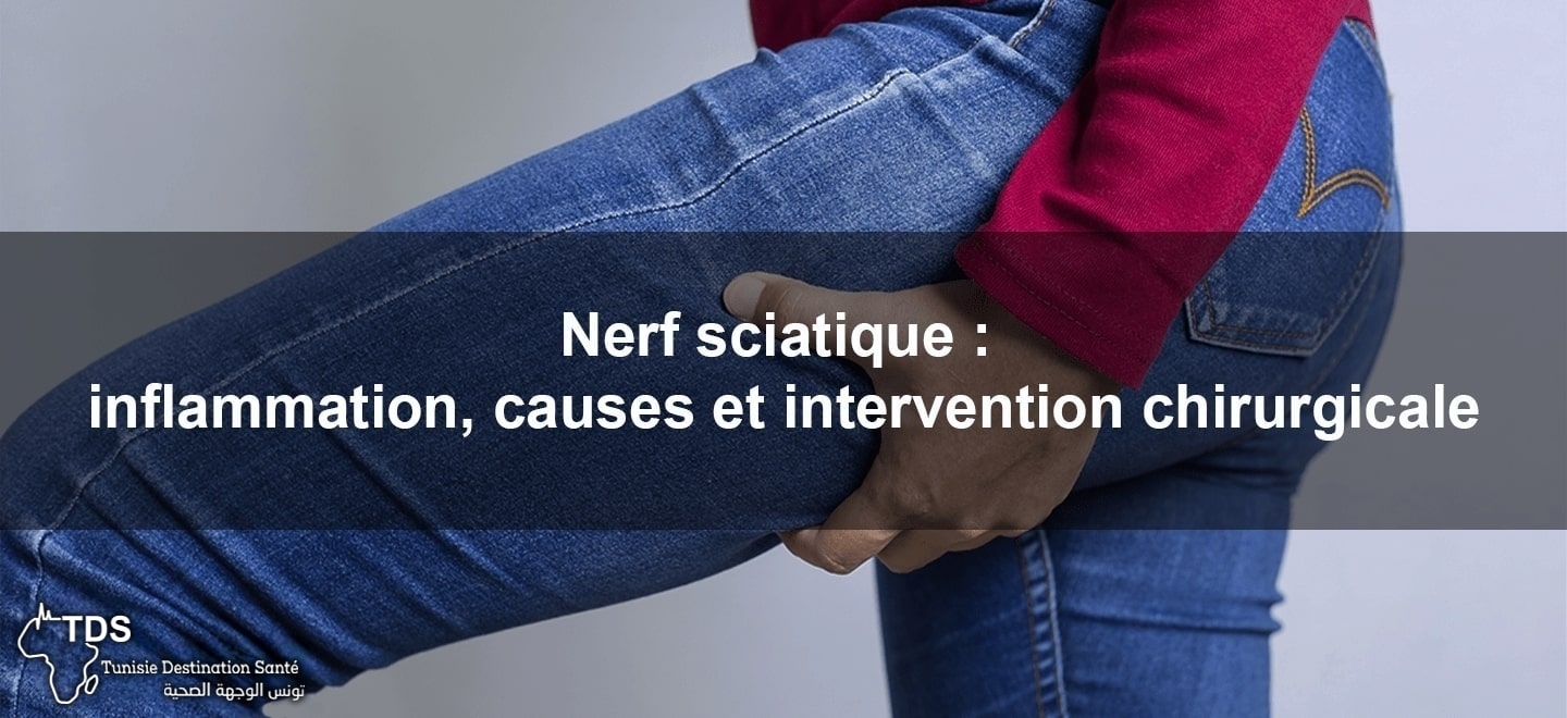 Nerf sciatique